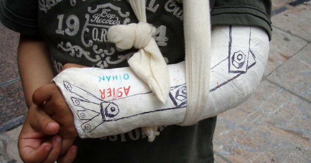 Em vaig trencar el braç