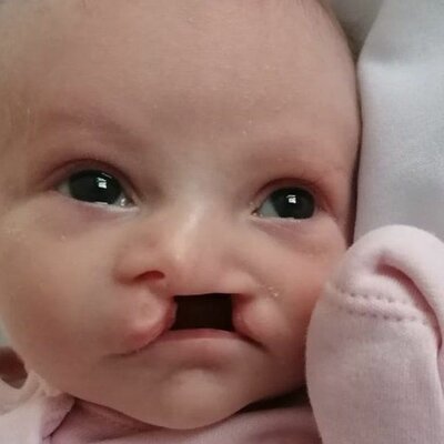 Timeline: Prenatal Development Baby