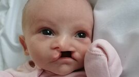 Timeline: Prenatal Development Baby