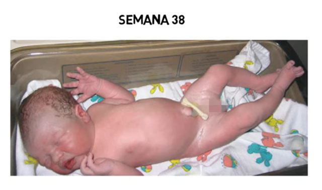 Feto a término | Semanas 37 a 40