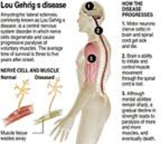 The release of the Hawkings from the hospital