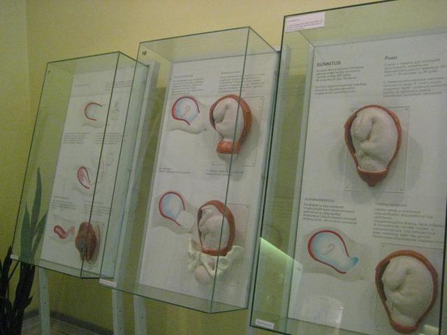 Был создан отдел музея в Таллинне