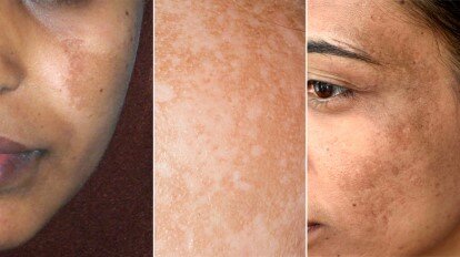 Second Trimester Week 14