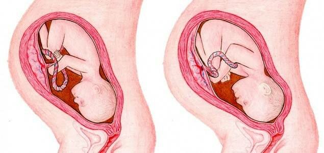 weeks 36-37