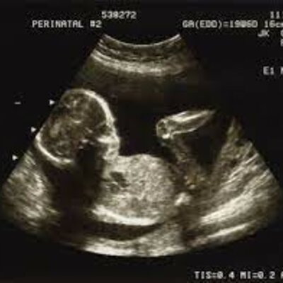 Timeline: Stages of pregnancy- Mother