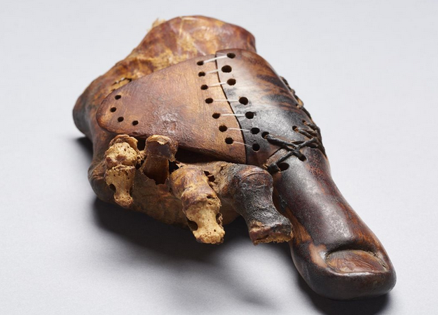 Miembros Ortopedicos