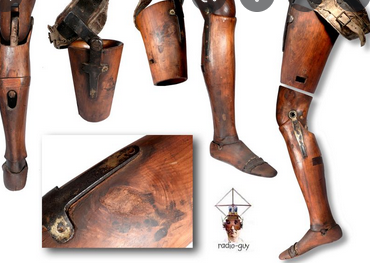 invención miembros ortopédicos