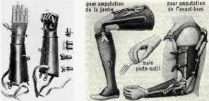 Miembros ortopédicos