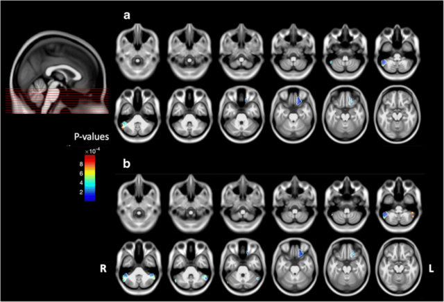 Sowell, Trauner, Gamst y Jemigan