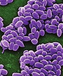 Enfermedad  del  ántrax