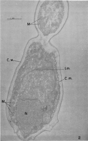 Visualização da levedura no microscópio eletrônico