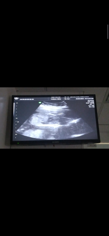 Emoción al ser madre