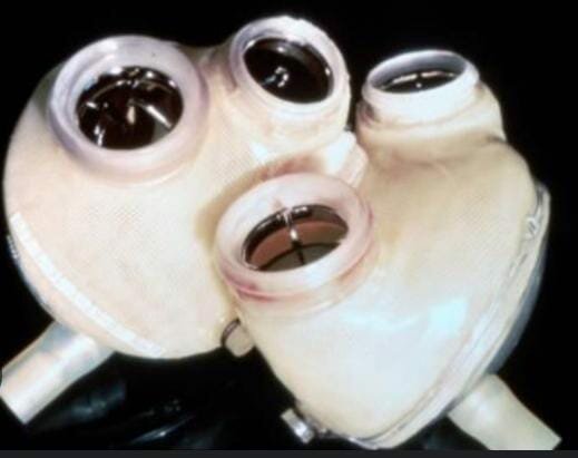 primer corazon artificial en humanos