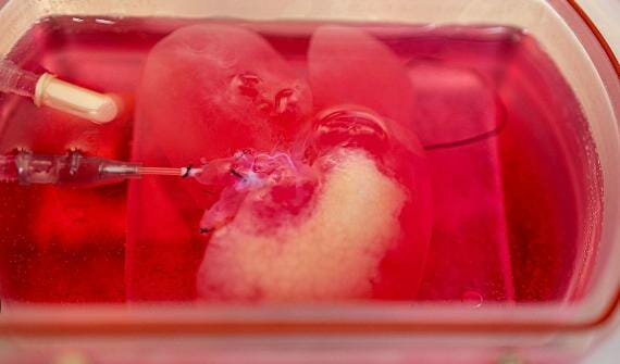 Mini higado a partir de celulas madres