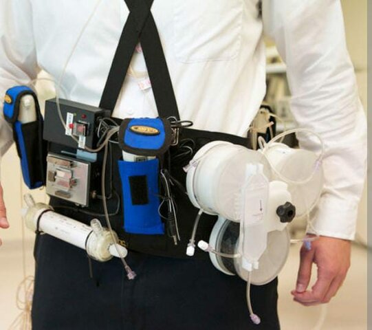 Primeros ensayos clinicos en un riñon artificial