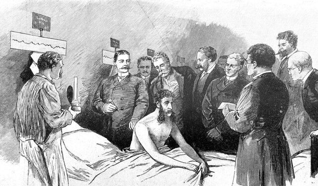 SMALLPOX VACCINE (vacuna contra la viruela)