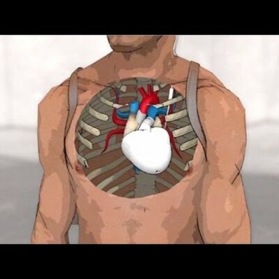 Timeline: Corazón artificial