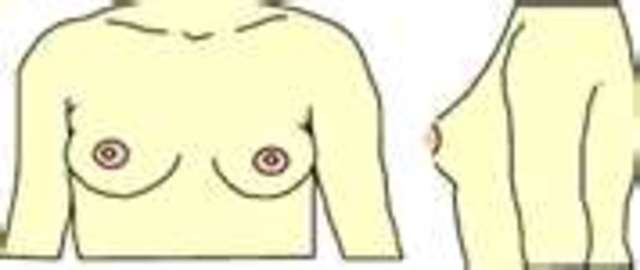 began developing breast