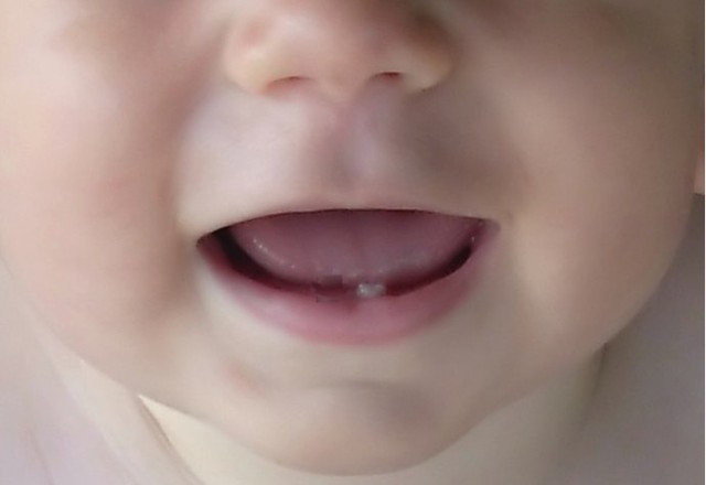 First Tooth