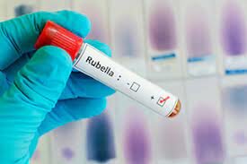 Rubella