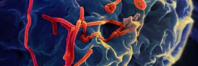 Ebola