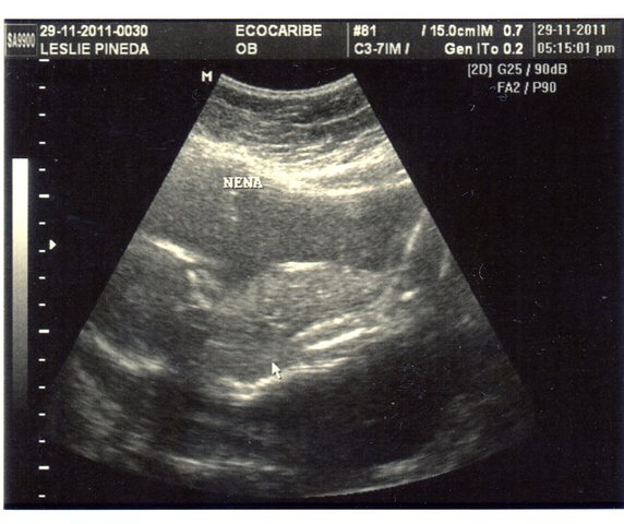 5° Ecografía. ES UNA NENA !!!!!!