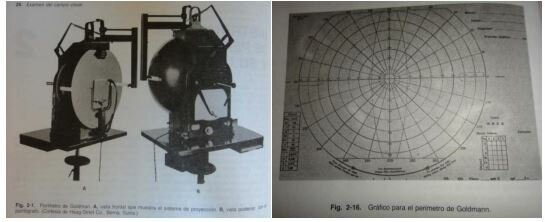 Goldmann/Campímetro