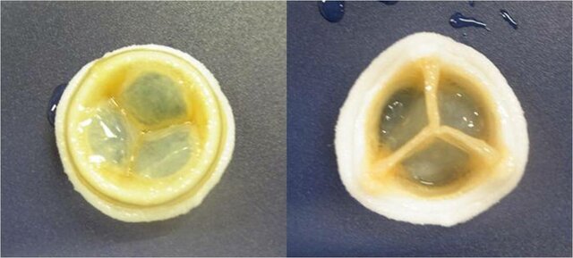 Válvulas cardíacas artificiales