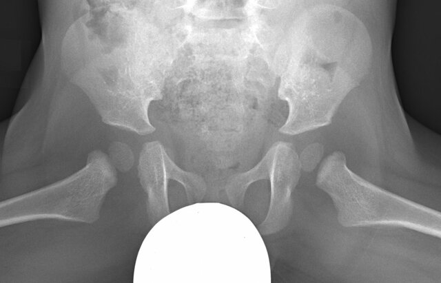 Patient Gonadal Shielding Introduced Into U.S. Code of Federal Regulations