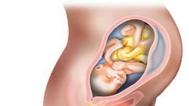 Protección a la mujer embarazada