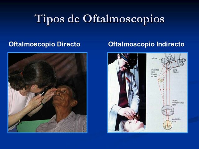 evolución del oftalmoscopio