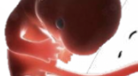 Timeline: Desarrollo embrionario y fetal.