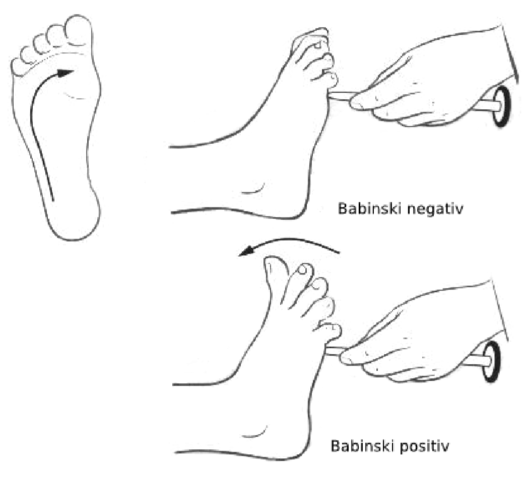 Reflejos Temporales 1