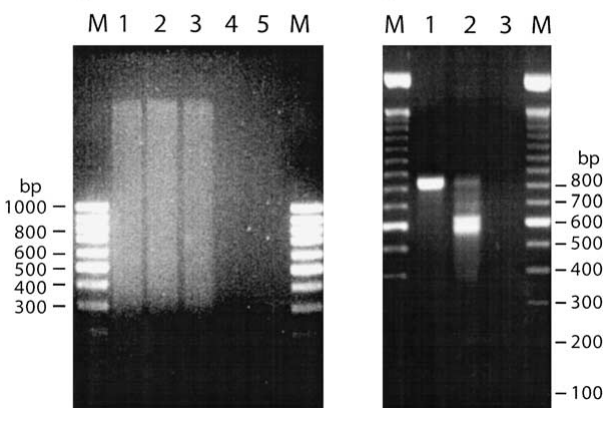 Presença da levedura de padeiro