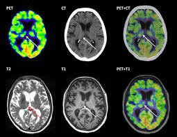 período Contemporáneo