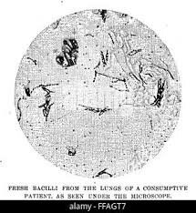 BACTÈRIA DE LA TUBERCULOSIS