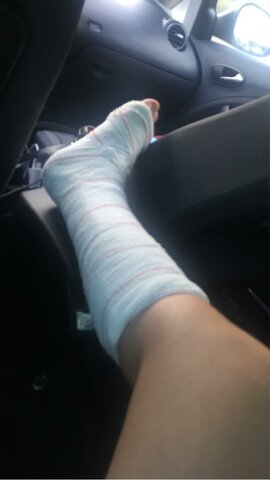 Base de tibia trencada (pais vasc)