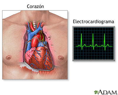 electrocardiograma