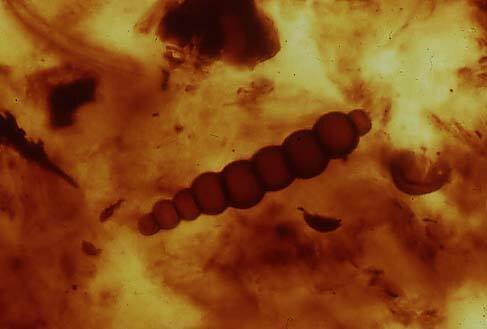 Se forman gran continente y células