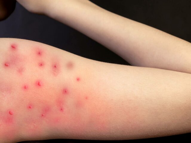 Hechos mas relevantes del Humanismo Exótico