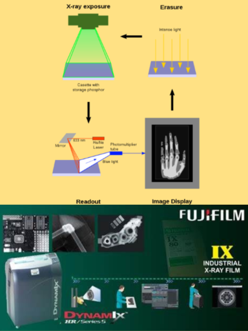 Computed Radiography