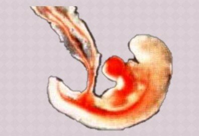 Día  20  Neurulación