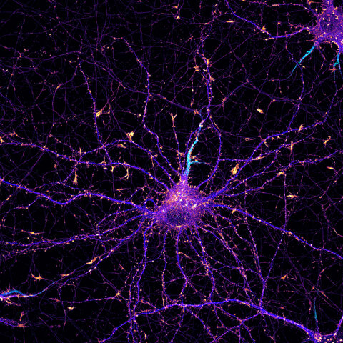 La microscopía de fluorescencia. Eric Betzig (1960-actualidad), William Moerner (1953-actualida) y Stefan Hell (1962-actualida)