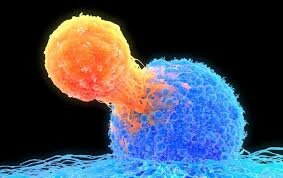 Wilson diagnosed with cancer