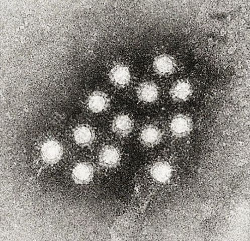 First vaccine developed for hepatitis A
