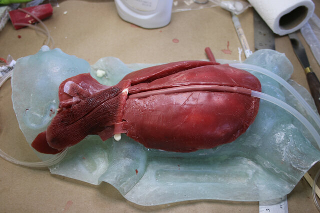 organos artificiales