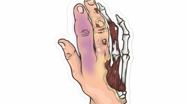 Timeline: Tanatología