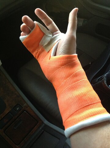 Broke my hand (strong)