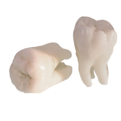 em cau la primera dent