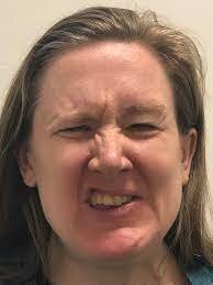 Diagnosed with Bell's Palsy